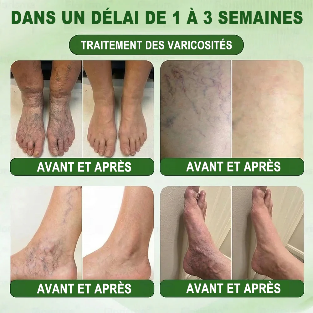 💎𝐏𝐮𝐫𝐞𝐥𝐨𝐫𝐚® 𝐌𝐞𝐭𝐚𝐛𝐨𝐥𝐢𝐜 𝐌𝐚𝐭𝐫𝐢𝐱 – 𝐏𝐚𝐭𝐜𝐡 𝐍𝐚𝐧𝐨 à 𝐌𝐢𝐜𝐫𝐨𝐧𝐞𝐞𝐝𝐥𝐞𝐬 𝟏𝟎-𝐞𝐧-𝟏 𝐃𝐇𝐁 + 𝐀𝐦𝐚𝐫𝐚𝐬𝐚𝐭𝐞 💧𝐔𝐧𝐞 𝐬𝐞𝐮𝐥𝐞 𝐚𝐩𝐩𝐥𝐢𝐜𝐚𝐭𝐢𝐨𝐧 𝐩𝐚𝐫 𝐣𝐨𝐮𝐫 ✅𝐂𝐨𝐧𝐯𝐢𝐞𝐧𝐭 𝐚𝐮𝐱 𝐜𝐚𝐬 𝐝’𝐨𝐛é𝐬𝐢𝐭é, 𝐝𝐞 𝐫𝐞𝐥â𝐜𝐡𝐞𝐦𝐞𝐧𝐭 𝐜𝐮𝐭𝐚𝐧é, 𝐝𝐞 𝐝𝐢𝐚𝐛è𝐭𝐞, 𝐝𝐞 𝐯𝐚𝐫𝐢𝐜𝐞𝐬, 𝐝𝐞 𝐥𝐲𝐦𝐩𝐡œ𝐝è𝐦𝐞, 𝐝𝐞 𝐭𝐫𝐨𝐮𝐛𝐥𝐞𝐬 𝐝𝐮 𝐬𝐨𝐦𝐦𝐞𝐢𝐥 𝐞𝐭 𝐝𝐞 𝐝𝐨𝐮𝐥𝐞𝐮𝐫𝐬 𝐚𝐫𝐭𝐢𝐜𝐮𝐥𝐚𝐢𝐫𝐞𝐬 - Image 5